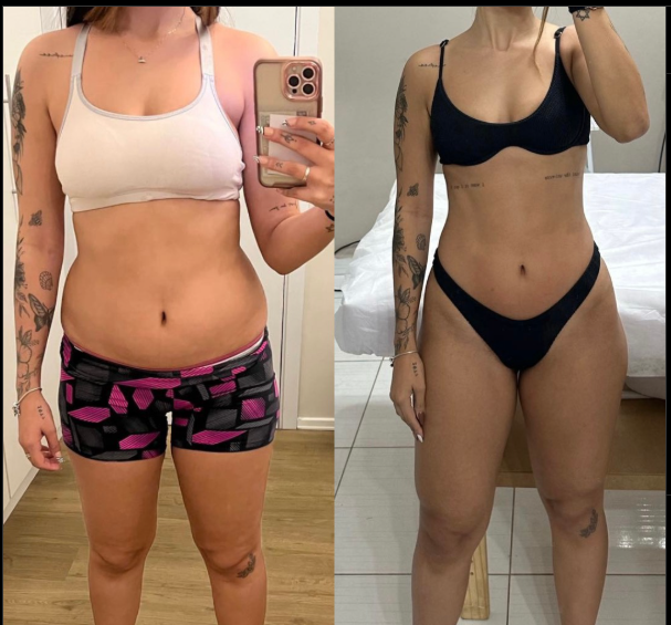 Antes e Depois